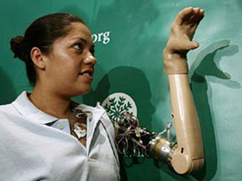 Клаудия Митчелл демонстрирует свою руку. Фото Telegraph.