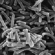 Bacillus pasteurii — возможный стабилизатор зданий в сейсмоопасных районах 
