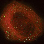 На снимке зелёным показаны точки расположения белка TRIM5α внутри клетки, защищающего её от действия ретровируса 